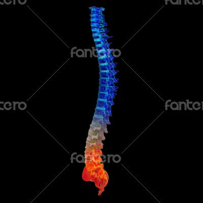 3d render painful spine