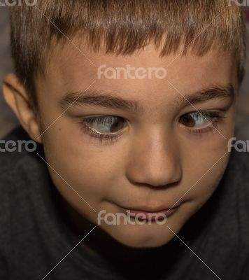 crossed eyes crossed eyes