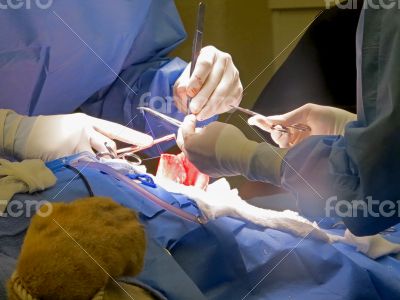 Stomach Suturing Stomach Suturing