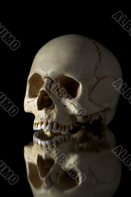 cranium