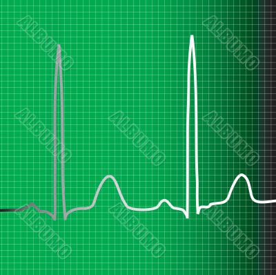 green ecg