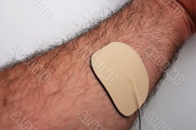 Electrodes