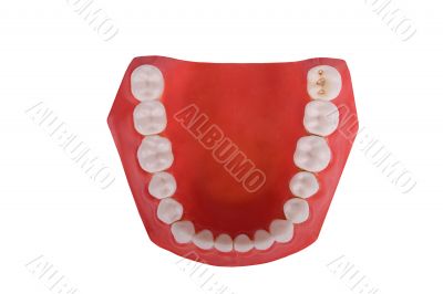 dentures, dental prosthesis