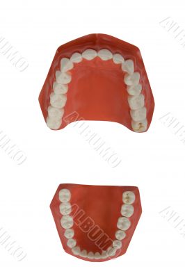 dentures, dental prosthesis