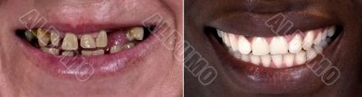 Before and after