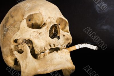 Smoking Kills - Side View