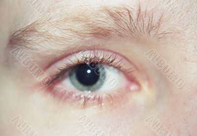 Blue Eye