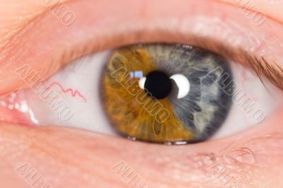 Macro shot of different colored human eye
