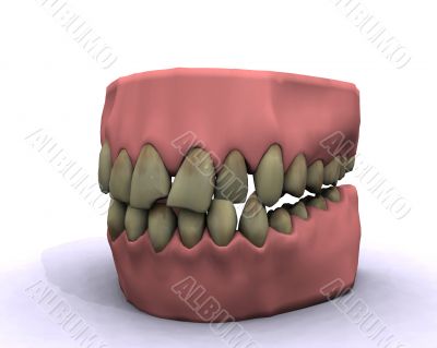 bad hygiene teeth
