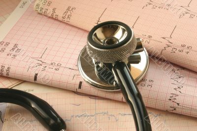 cardiological test analysis