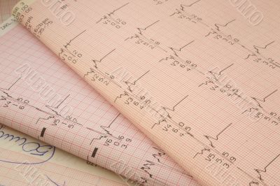 cardiological test results
