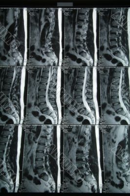 MRI result 2