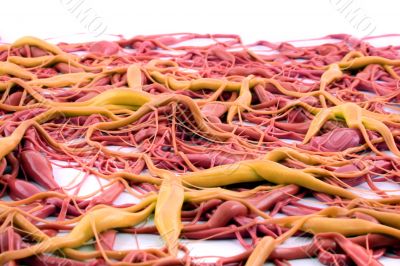 Red Neurons