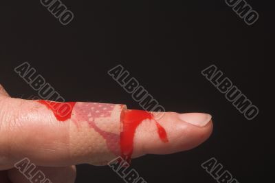 Bleeding Finger