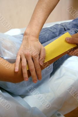 epilation hair
