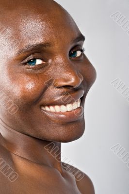 Bald and beautiful