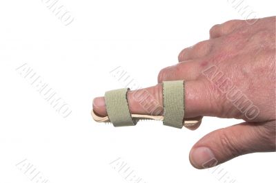 Broken Finger