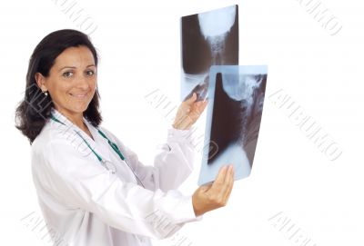 Doctor analyzing a radiography