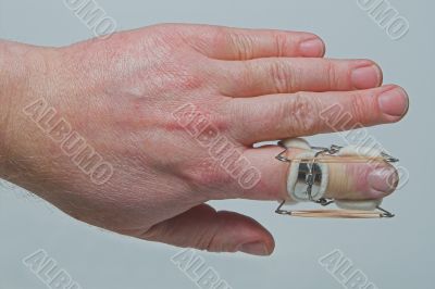 Finger Brace