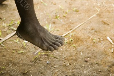 Foot