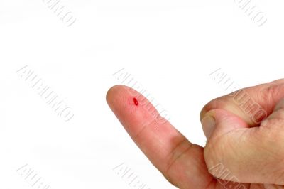 Bloody Forefinger