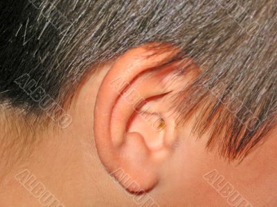 Ear Wax