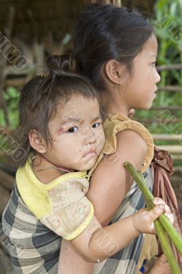 Hmong siblings, Laos