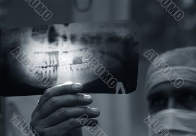Doctor with x-ray