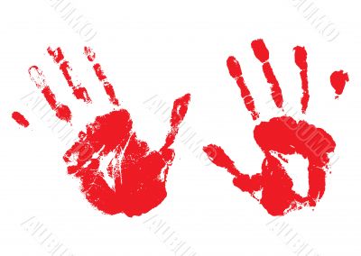 bloody hands