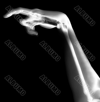 Bone Hand