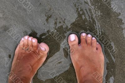 Sunburnt female leg