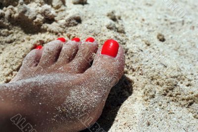 Sunburnt female leg