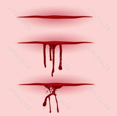 blood cut