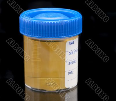 urine test specimen