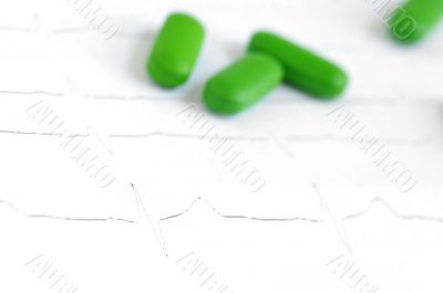 Close-up of real ecg graph