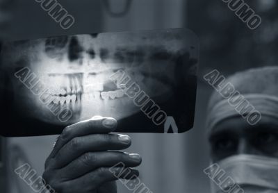 Doctor with x-ray