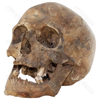 Human Skull