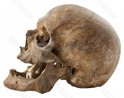 Human Skull