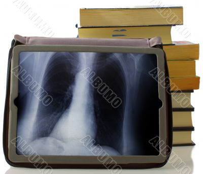 Radiography