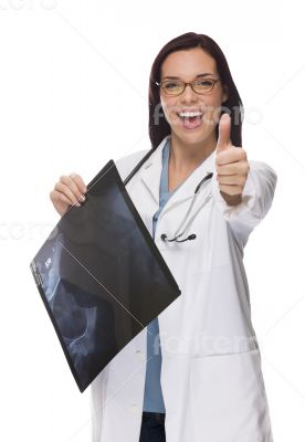 Mixed Race Thumbs Up Female Doctor or Nurse Holding X-ray