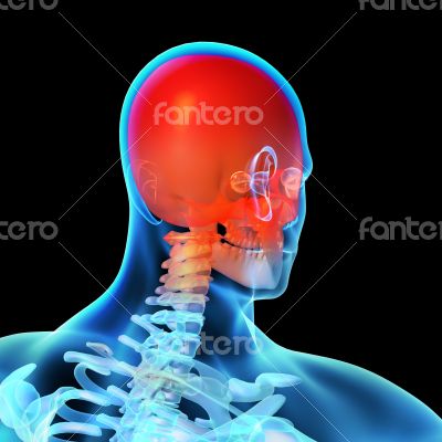 3d rendered illustration - painful head