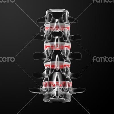 intervertebral discs