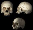 craniums