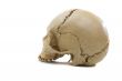 cranium
