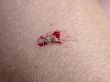 Mosquito on my hand. Part 7. Final