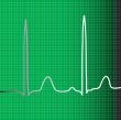 green ecg