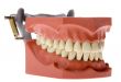 Dental mold 3
