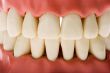 Dental mold 2