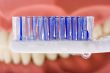 Dental mold and toothbrush