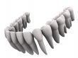 Lower teeth 2